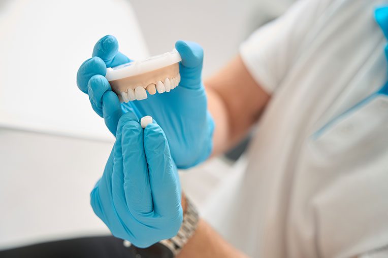 why do I need a crown after a root canal?